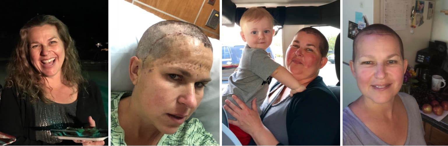 4 stages of Stacy's brain cancer journey